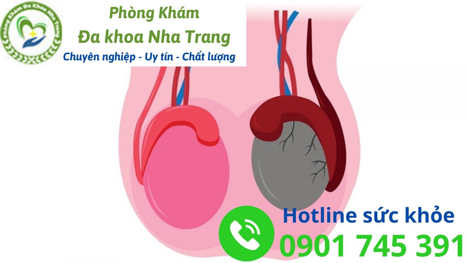 Một số triệu chứng gây đau tinh hoàn phải