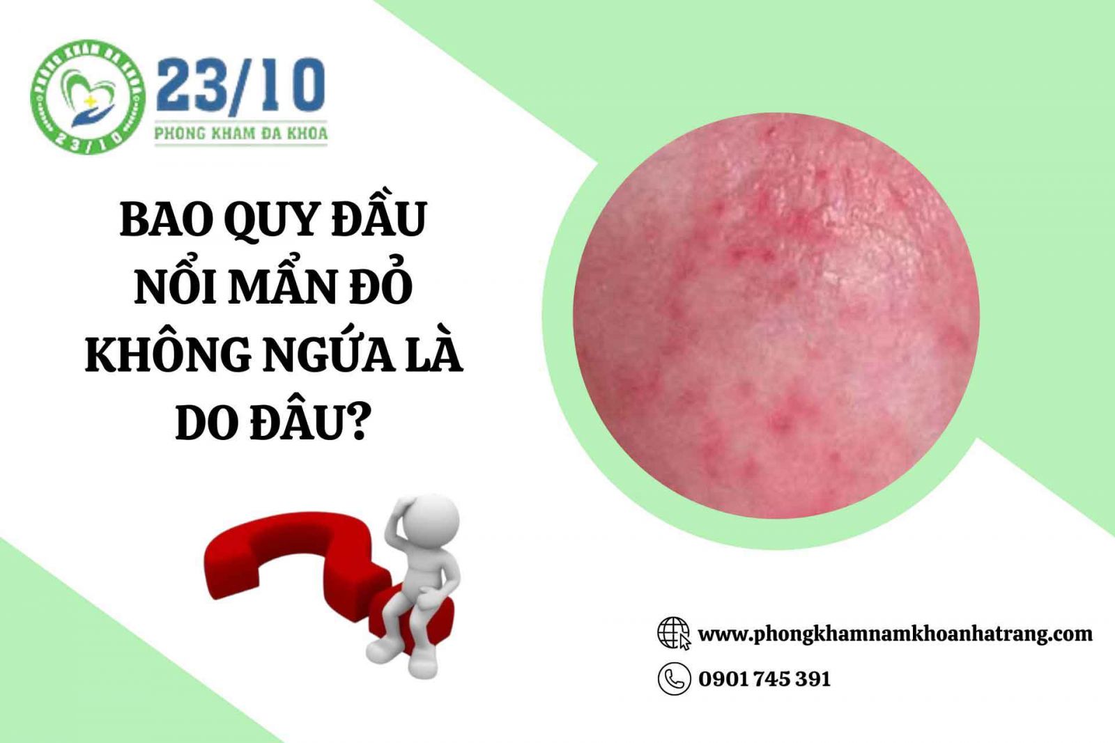 Bao quy đầu nổi mẩn đỏ không ngứa là do đâu?