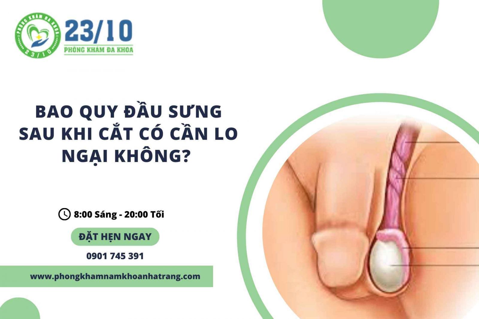 Bao quy đầu sưng sau khi cắt có cần lo ngại không?