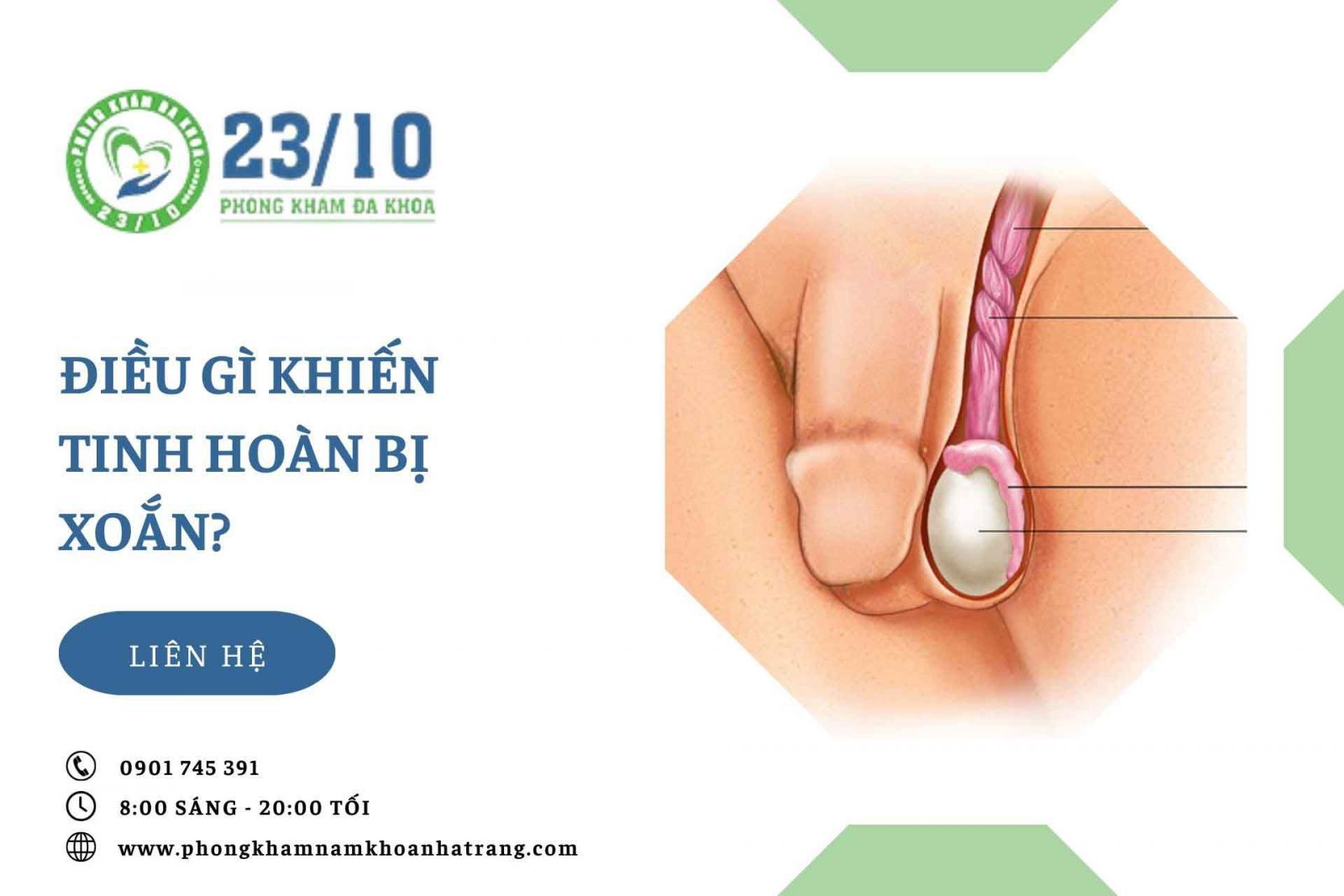 Điều gì khiến cho tinh hoàn bị xoắn?