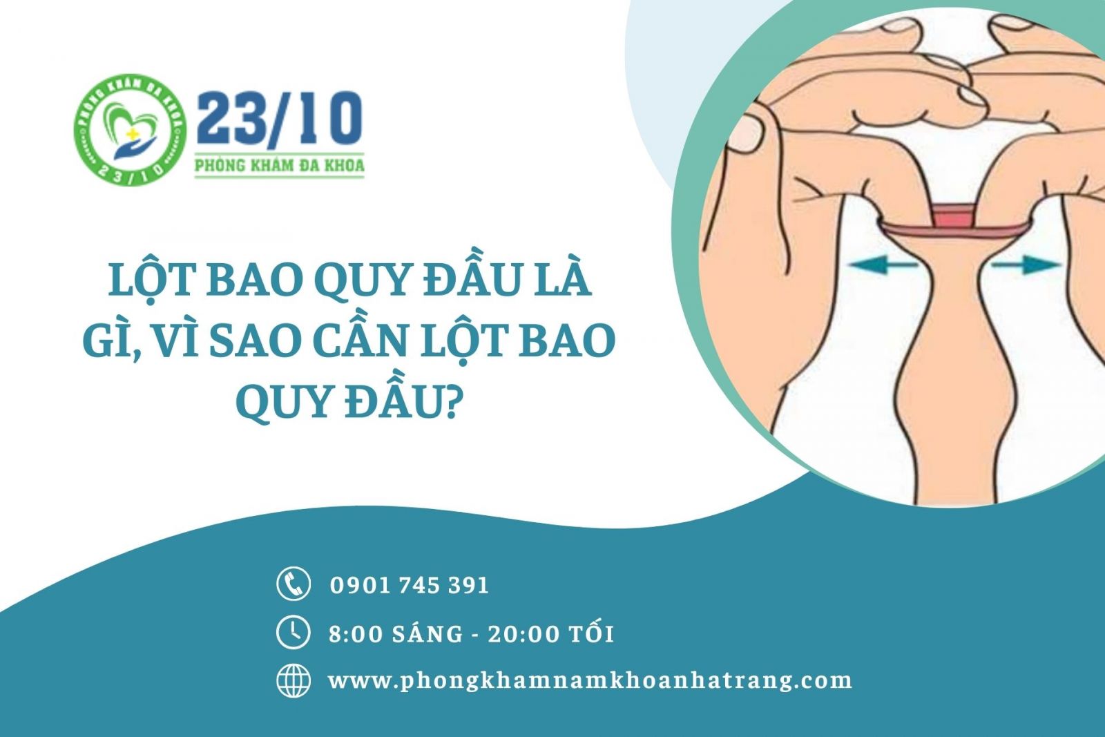 Lột bao quy đầu là gì? Vì sao nên lột bao quy đầu?