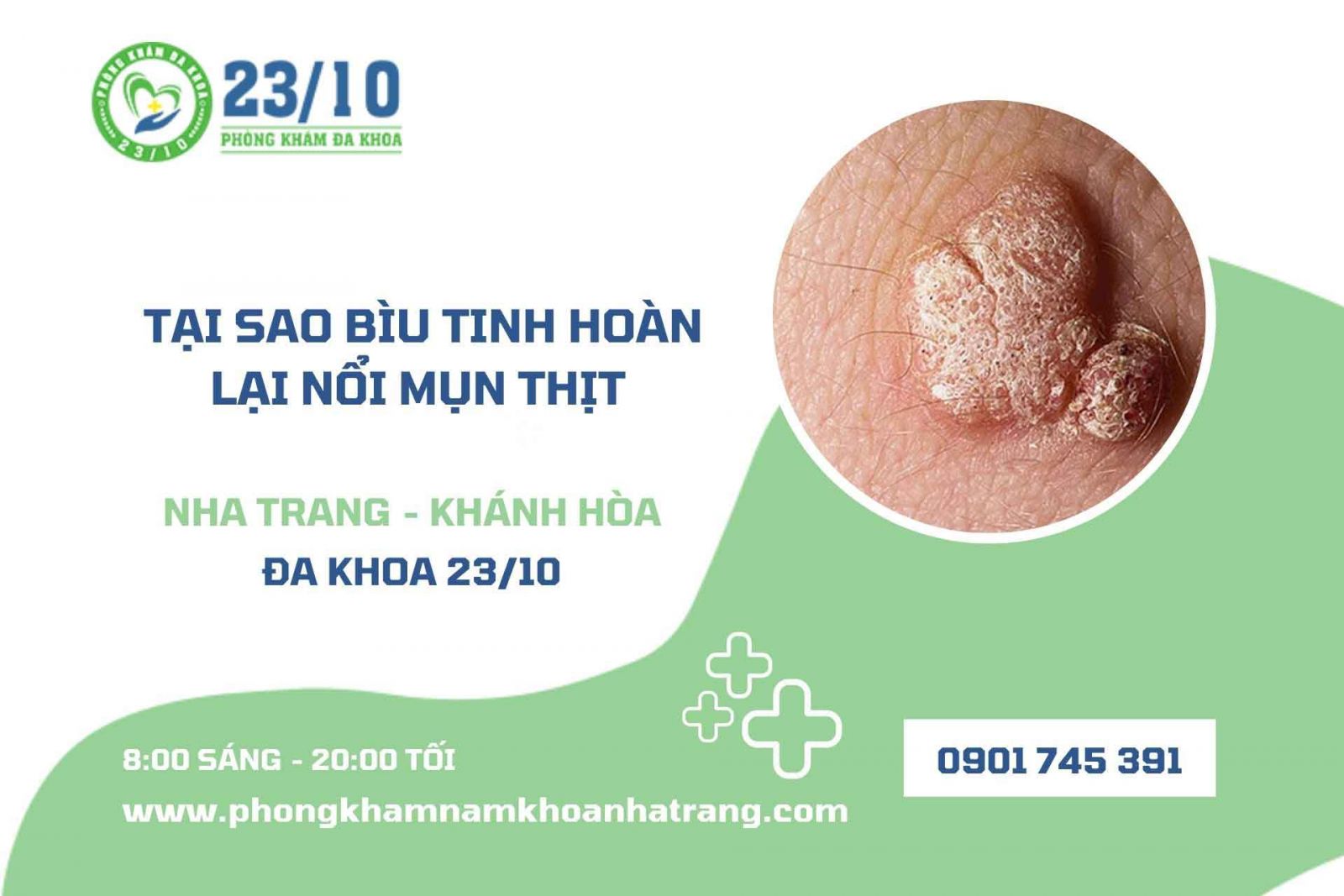 Tại sao bìu tinh hoàn lại nổi mụn thịt?