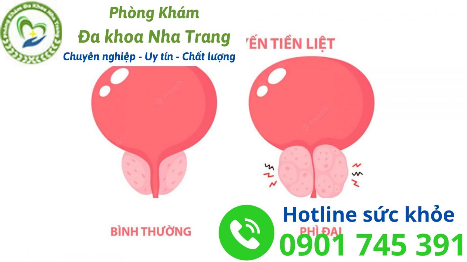 Phì đại tuyến tiền liệt có thể gây ra biến chứng gì?