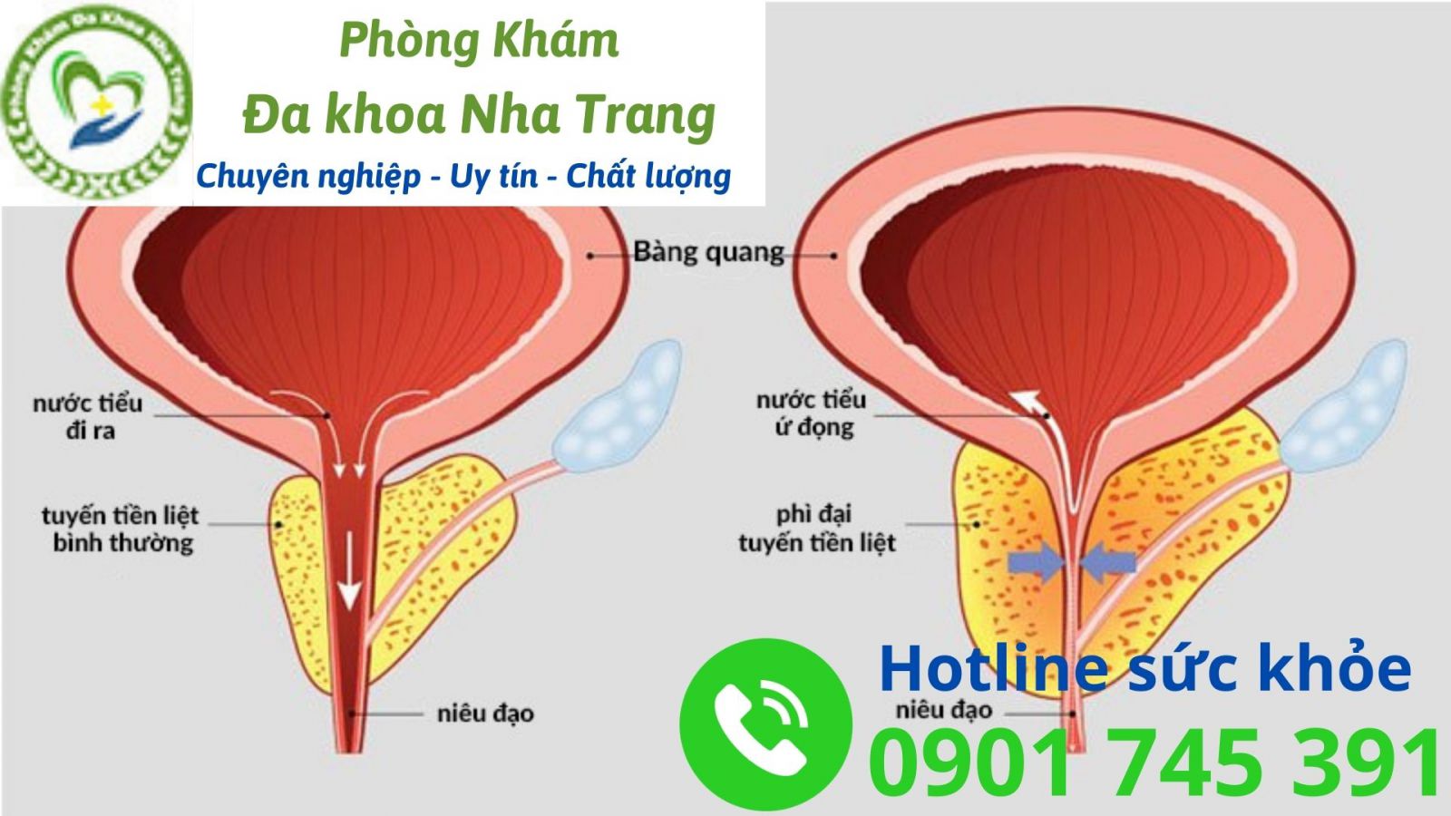 Tuyến tiền liệt đóng vai trò như thế nào đối với sức khỏe nam giới?