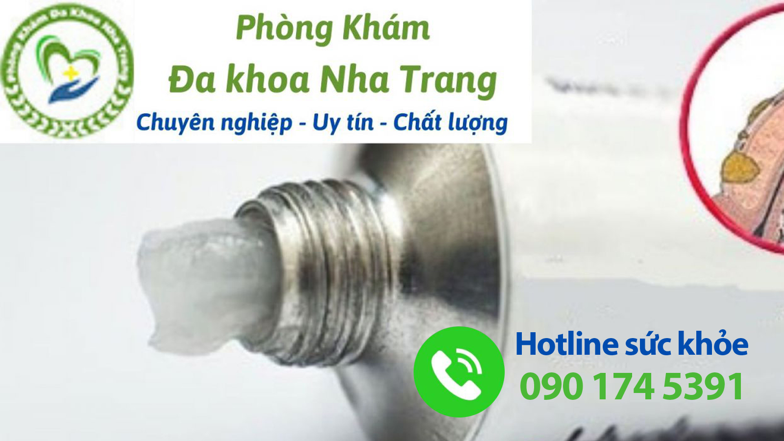 4 Loại thuốc bôi trị viêm bao quy đầu phổ biến, dễ sử dụng