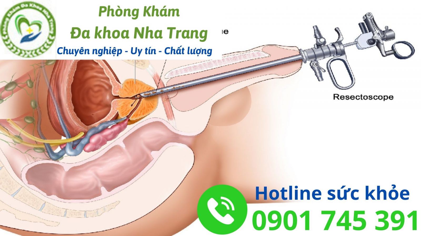 Triệu chứng nhận biết bị u xơ tuyến tiền liệt