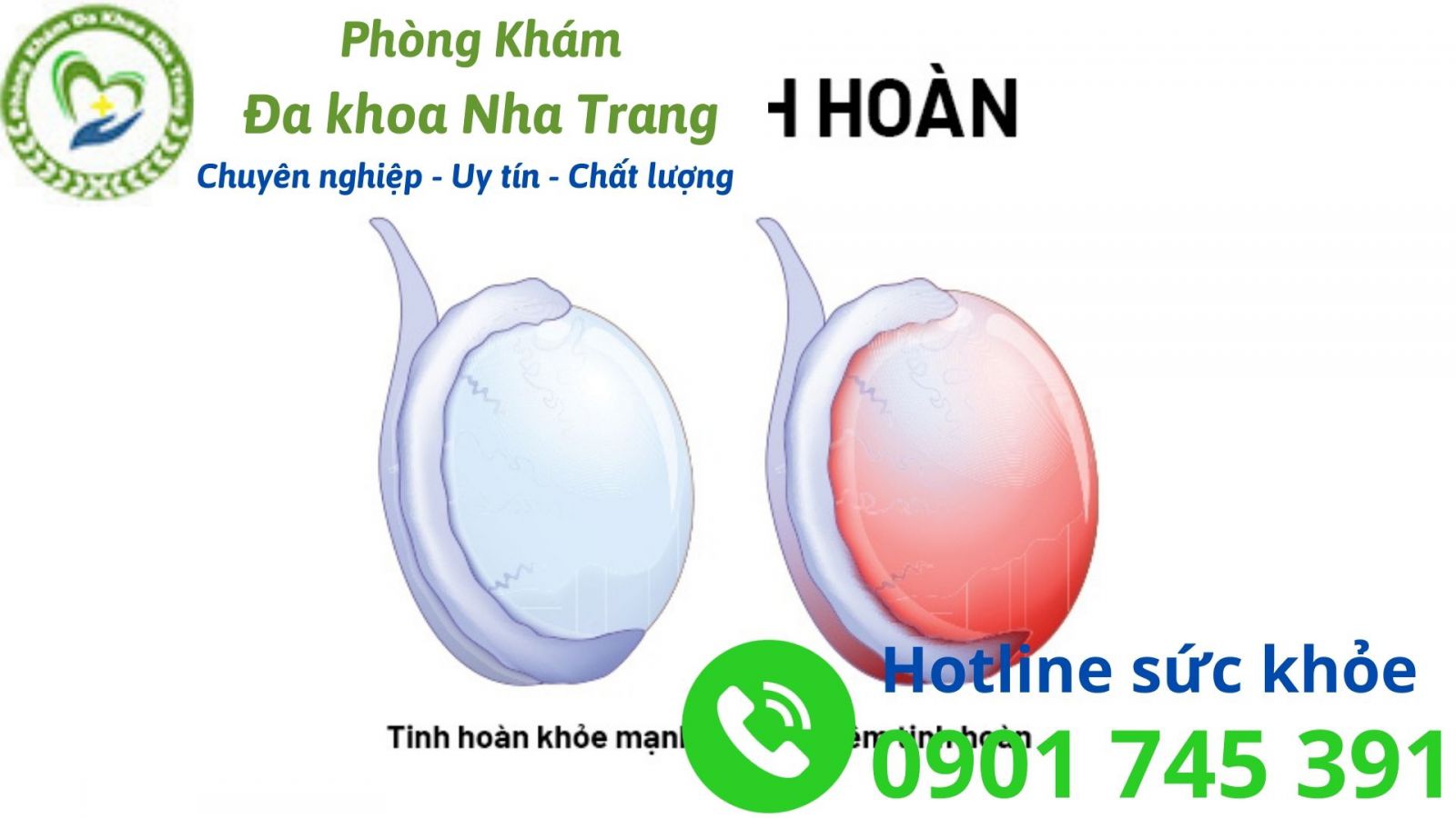 Tình trạng viêm tinh hoàn ở nam giới