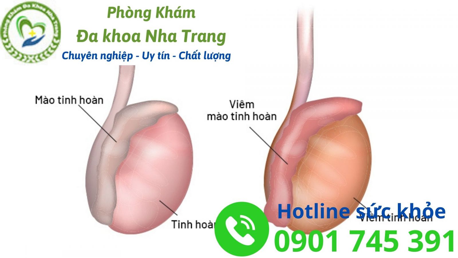 Một số triệu chứng viêm tinh hoàn 