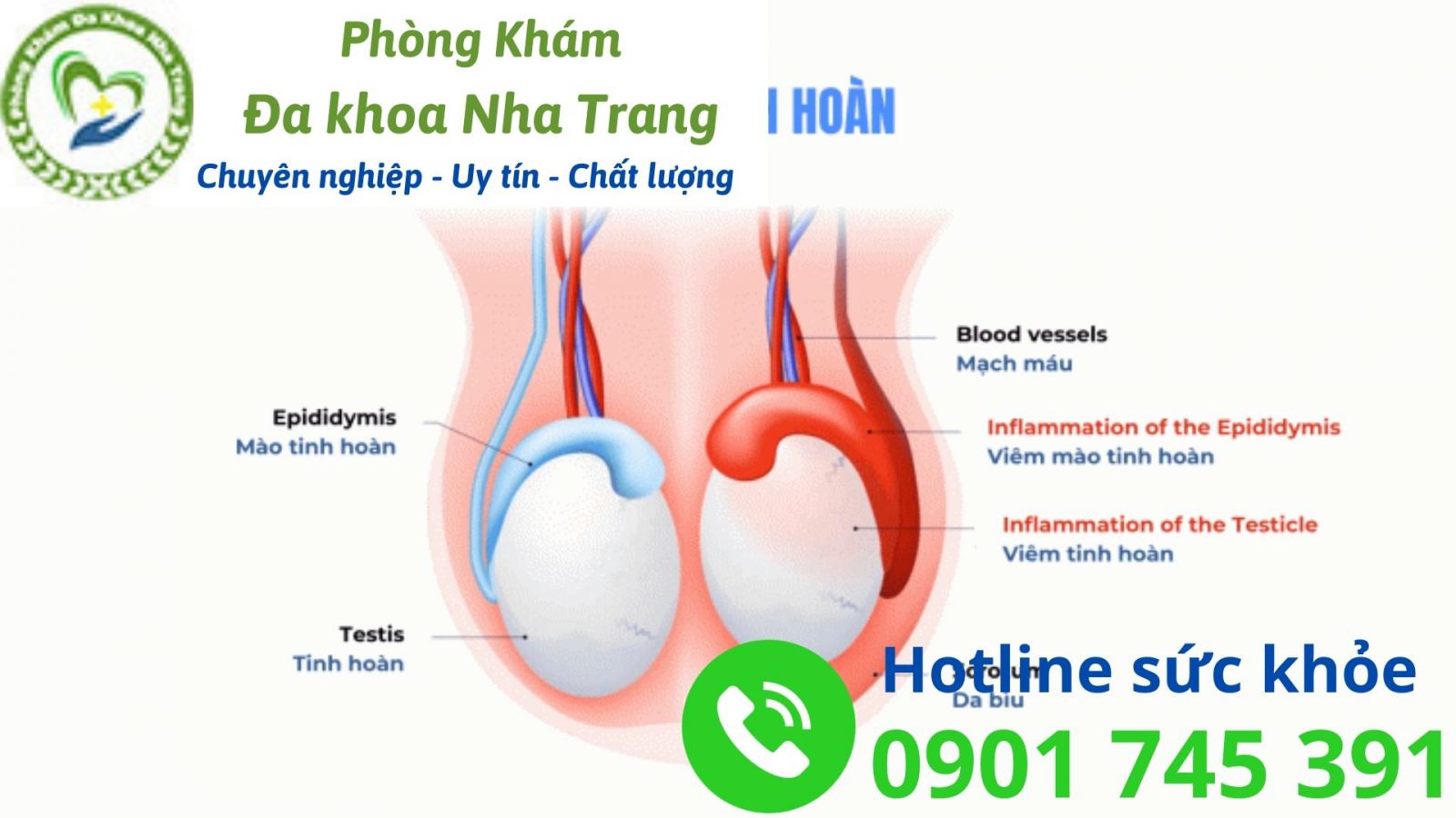 Nam giới bị viêm tinh hoàn có nguy hiểm không?